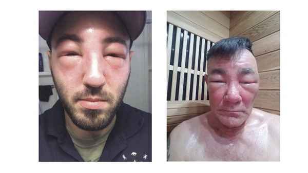 十大毒蜂图片排名,蜂的种类及图片大全