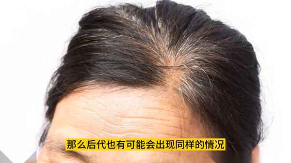 中学生白发是什么原因_中学生白发是什么原因分析