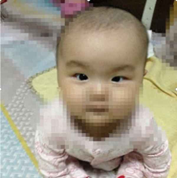 小孩子对眼是什么原因引起的;小孩子对眼是什么原因引起的6个月 - 寻医问药 - 华网，华网资讯，华网头条，华人网络家园