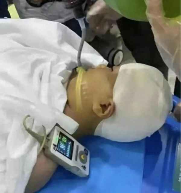 头部被暴击的后果;头部被暴击的后果有哪些