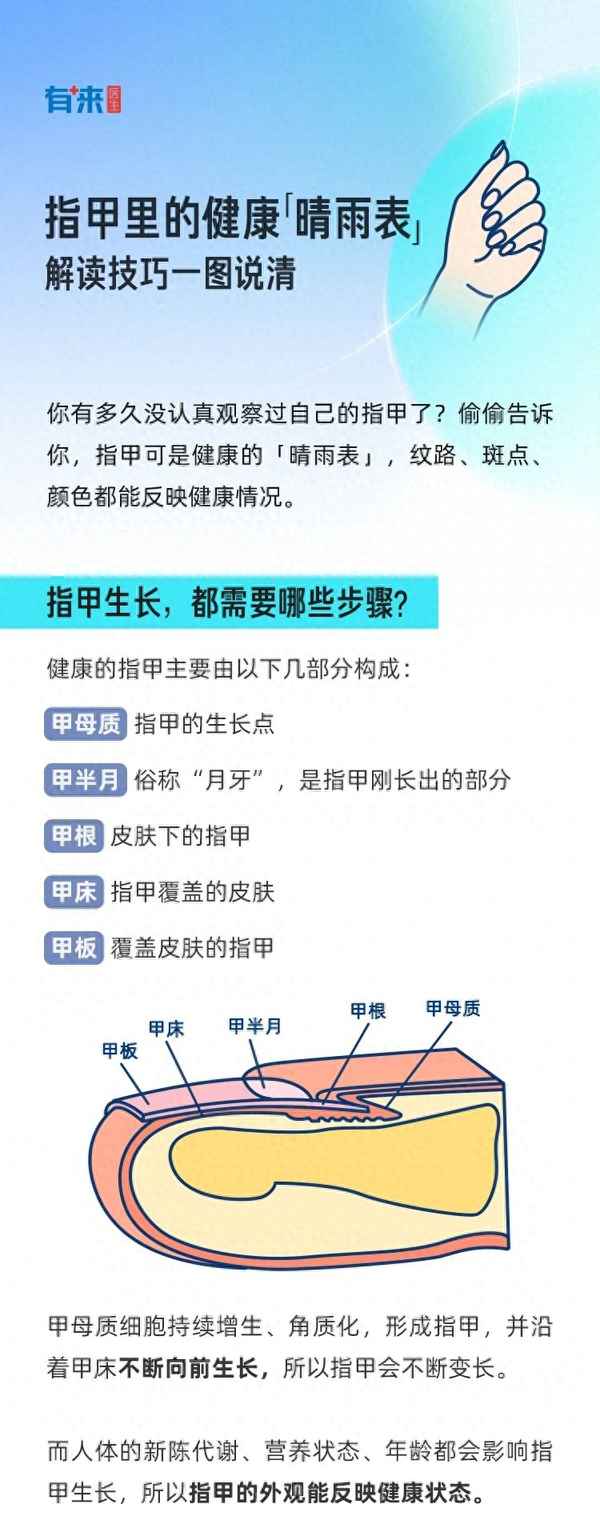 手指甲颜色健康对照表(手指甲颜色健康对照表 图解)