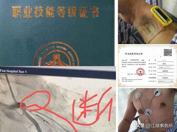 醫療手表哪個牌子好【醫療級手表評測】