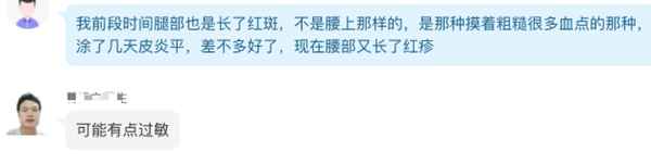 一鍵識(shí)別皮膚病免費(fèi);拍照自測(cè)皮膚病